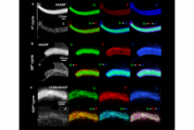 Cryo-STEM imagery showing the structural and chemical evolution of silicon and the solid-electrolyte interphase layer